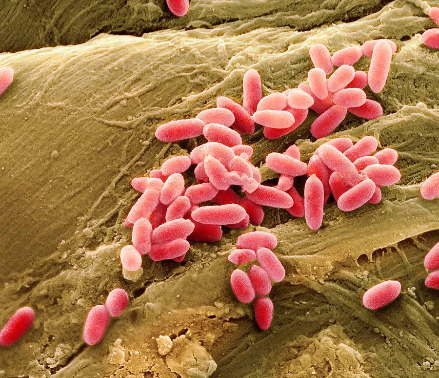 vi-sinh-vat-pseudomonas